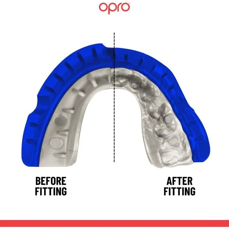 F34462     ~ OPRO ORTHO GOLD M/GUARD BLUE